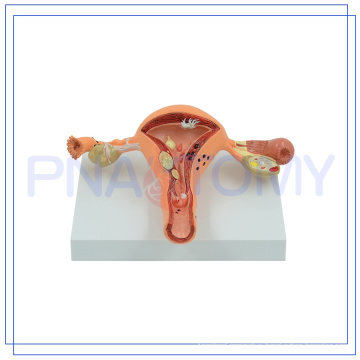 PNT-0742 Factory Directly anatomy uterus model With Good Service